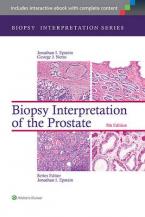 BIOPSY INTERPRETATION OF THE PROSTATE  HC