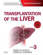 TRANSPLANTATION OF THE LIVER  HC